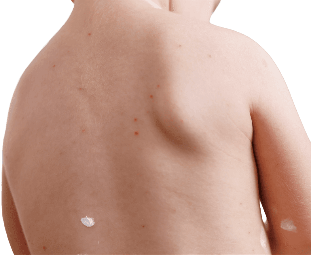 Compounding solutions and packaging